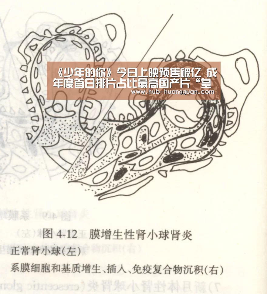 皇冠足球